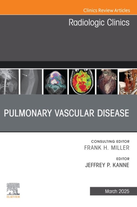 Cover image for book Pulmonary Vascular Disease, An Issue of Radiologic Clinics of North America