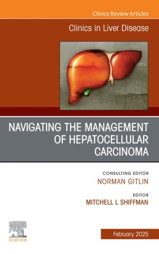 Navigating the Management of Hepatocellular Carcinoma, An Issue of Clinics in Liver Disease