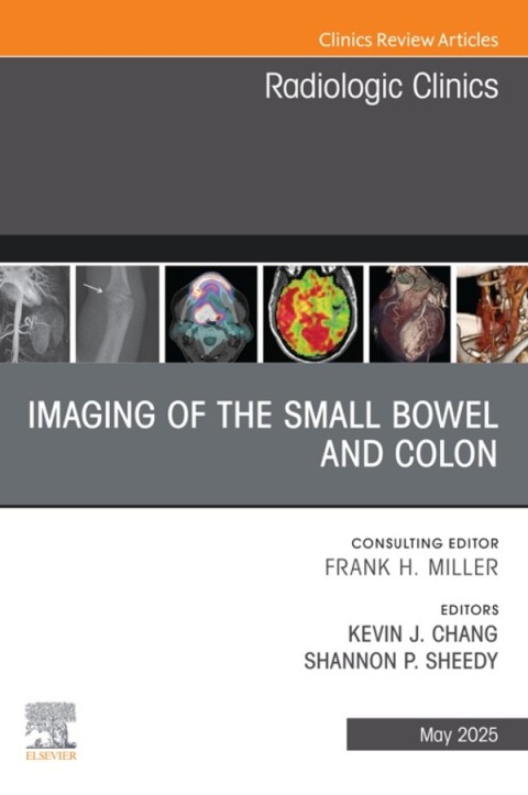 Cover image for book Imaging of the Small Bowel and Colon, An Issue of Radiologic Clinics of North America