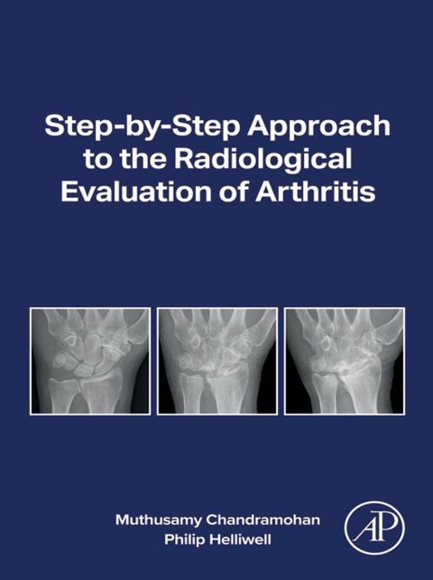 Cover image for book Step-by-step Approach to the Radiological Evaluation of Arthritis