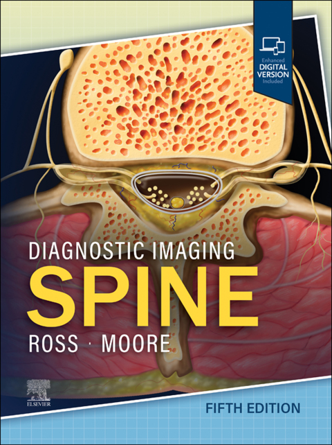 Diagnostic Imaging: Spine - E-Book 