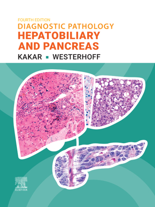 Diagnostic Pathology : Hepatobiliary and Pancreas - E-Book