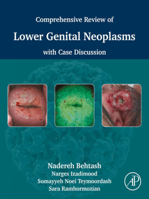 Cover image for book Comprehensive review of lower genital neoplasms