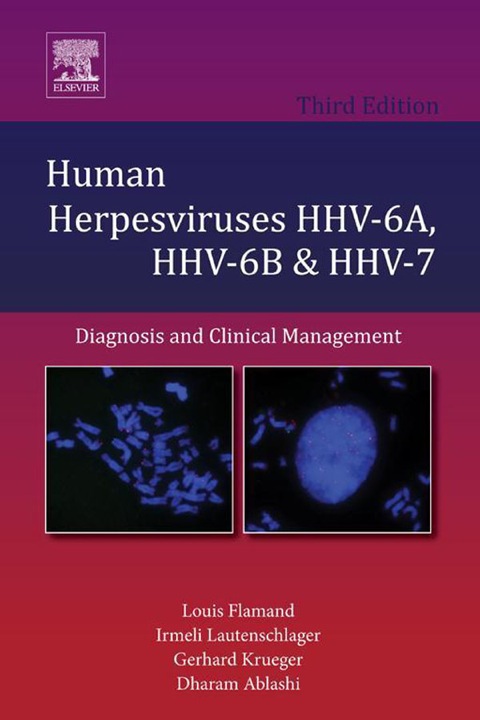 Cover image for book Human Herpesviruses HHV-6A, HHV-6B & HHV-7: Diagnosis and Clinical Management