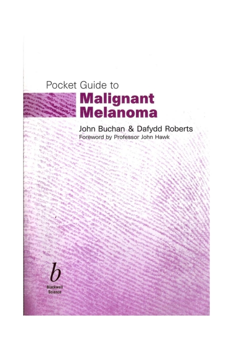 Cover image for book Pocket Guide to Malignant Melanoma