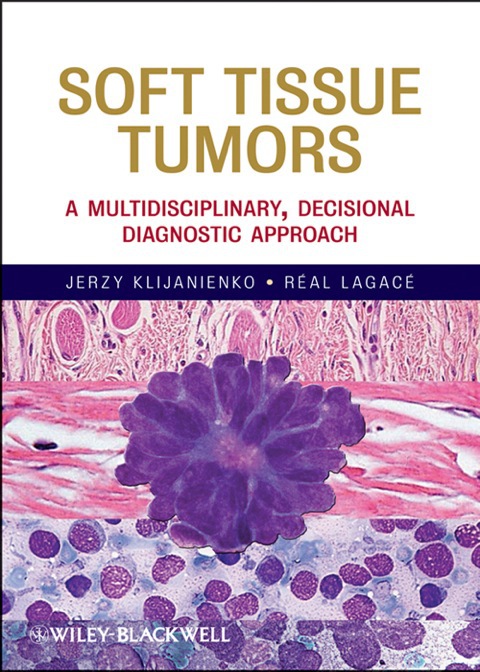Cover image for book Soft Tissue Tumors: A Multidisciplinary, Decisional Diagnostic Approach