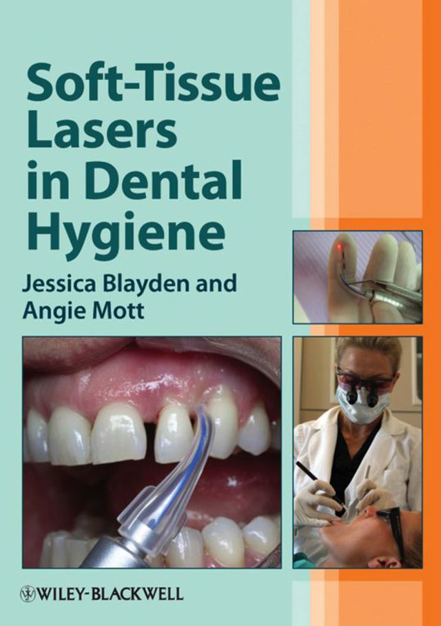 Soft Tissue Lasers in Dental Hygiene