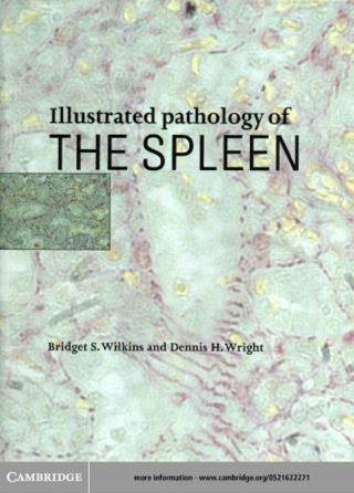 Illustrated Pathology of the Spleen