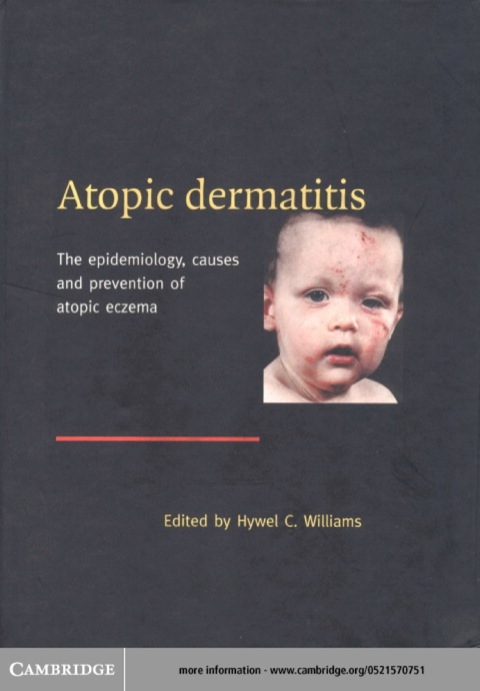 Atopic Dermatitis 