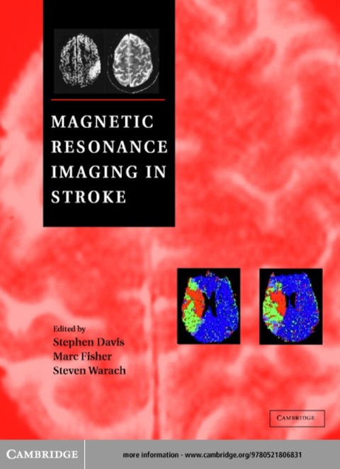 Cover image for book Magnetic Resonance Imaging in Stroke