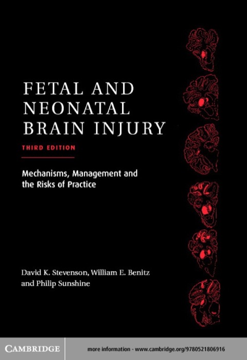 Cover image for book Fetal and Neonatal Brain Injury