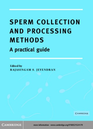 Sperm Collection and Processing Methods
