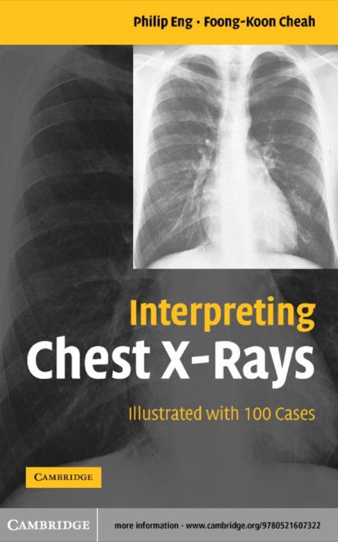 Cover image for book Interpreting Chest X-Rays