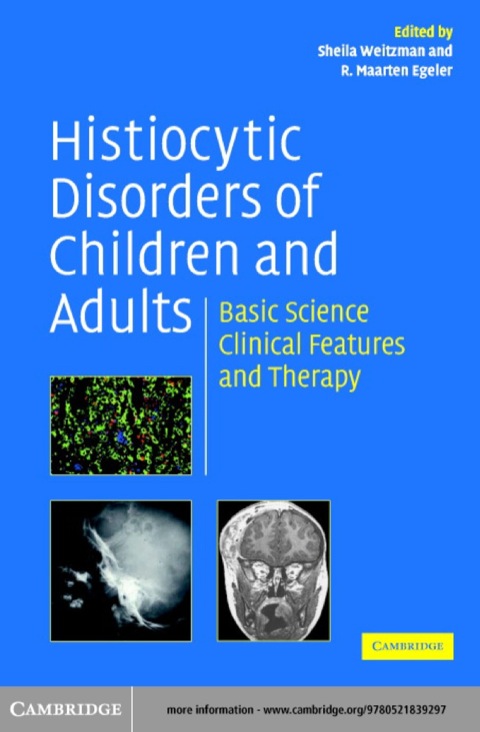 Cover image for book Histiocytic Disorders of Children and Adults