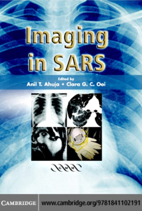 Cover image for book Imaging in SARS