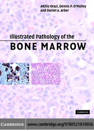 Illustrated Pathology of the Bone Marrow