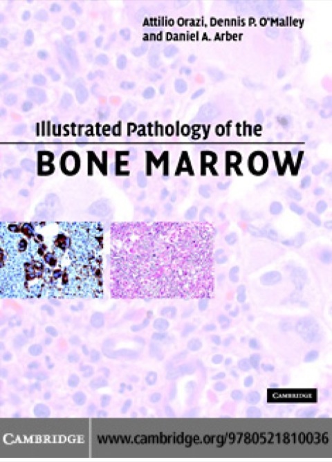 Illustrated Pathology of the Bone Marrow 