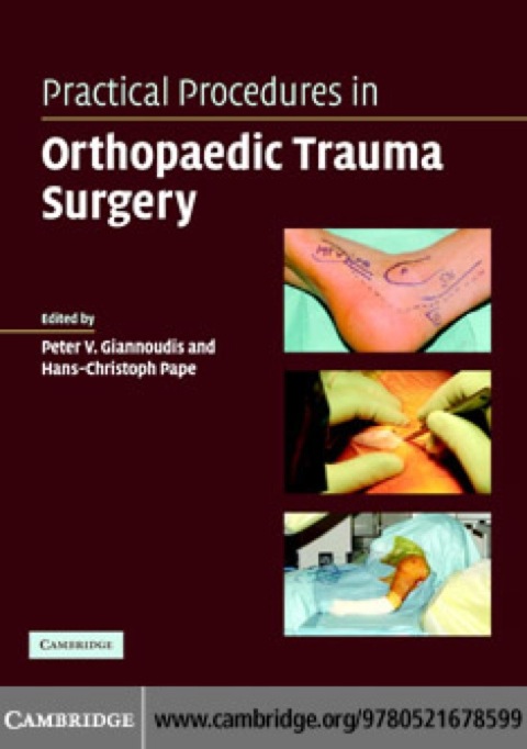 Cover image for book Practical Procedures in Orthopaedic Trauma Surgery
