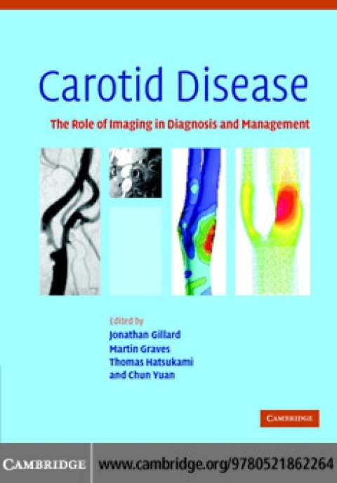 Cover image for book Carotid Disease