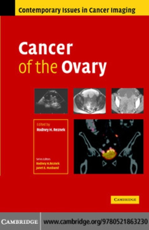 Cover image for book Cancer of the Ovary
