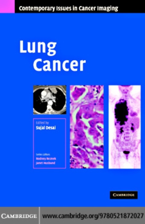 Cover image for book Lung Cancer