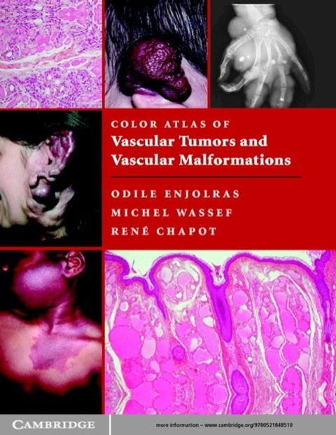Cover image for book Color Atlas of Vascular Tumors and Vascular Malformations