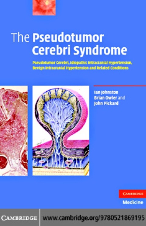 Cover image for book The Pseudotumor Cerebri Syndrome