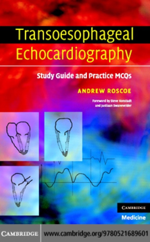 Cover image for book Transoesophageal Echocardiography
