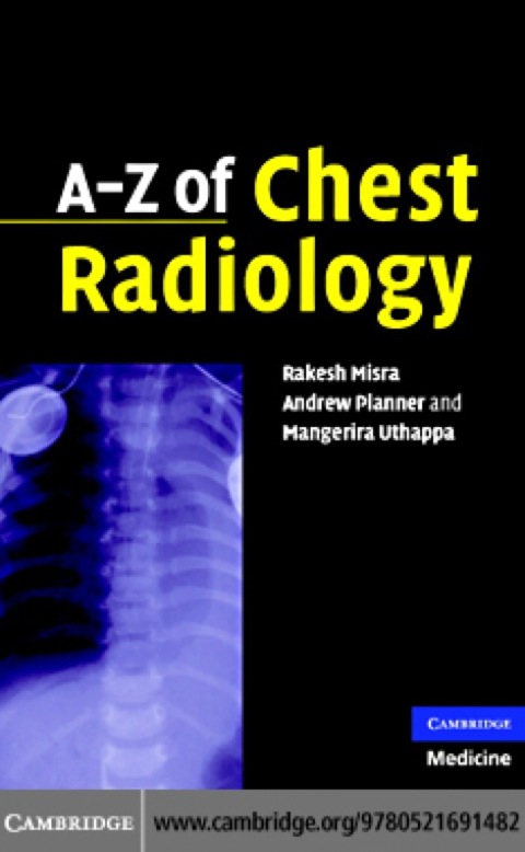 Cover image for book A-Z of Chest Radiology