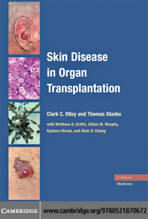Cover image for book Skin Disease in Organ Transplantation