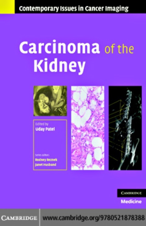 Cover image for book Carcinoma of the Kidney