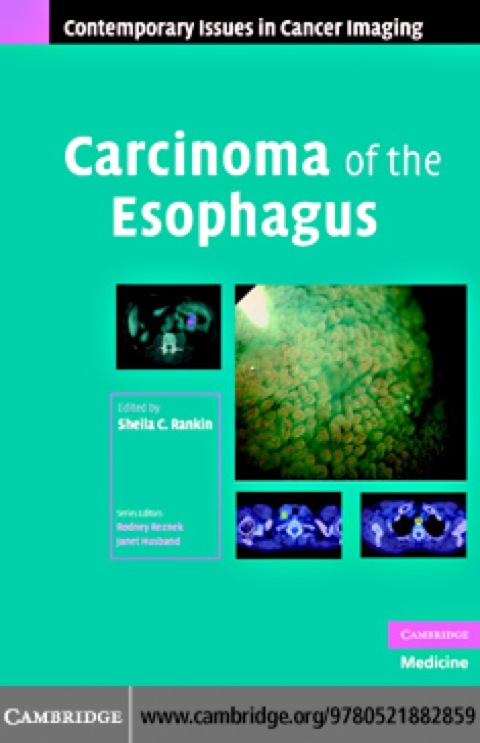 Cover image for book Carcinoma of the Esophagus