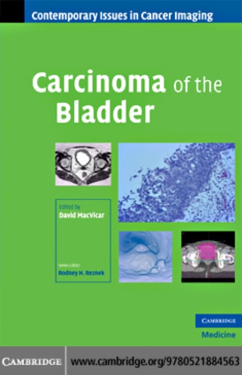 Cover image for book Carcinoma of the Bladder