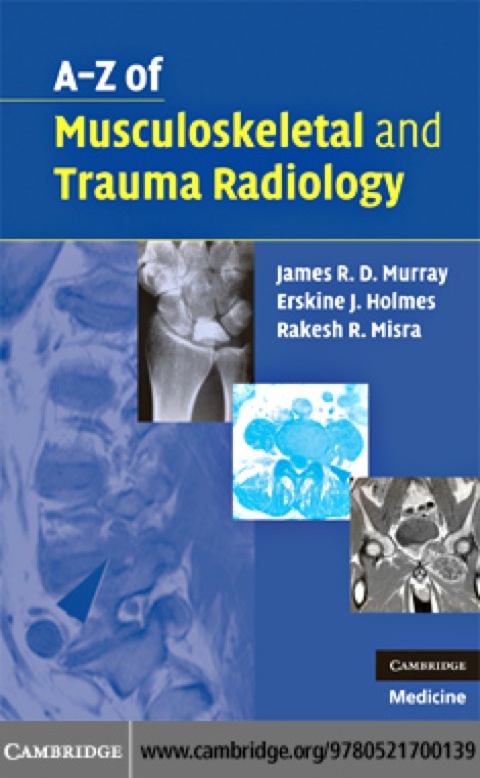 A-Z of Musculoskeletal and Trauma Radiology 