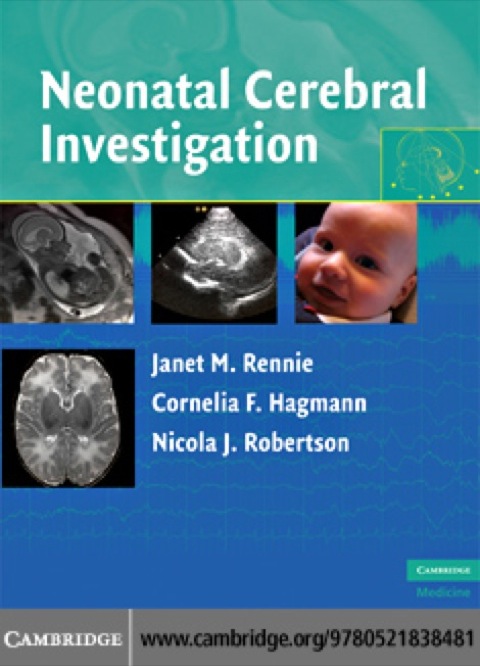 Cover image for book Neonatal Cerebral Investigation