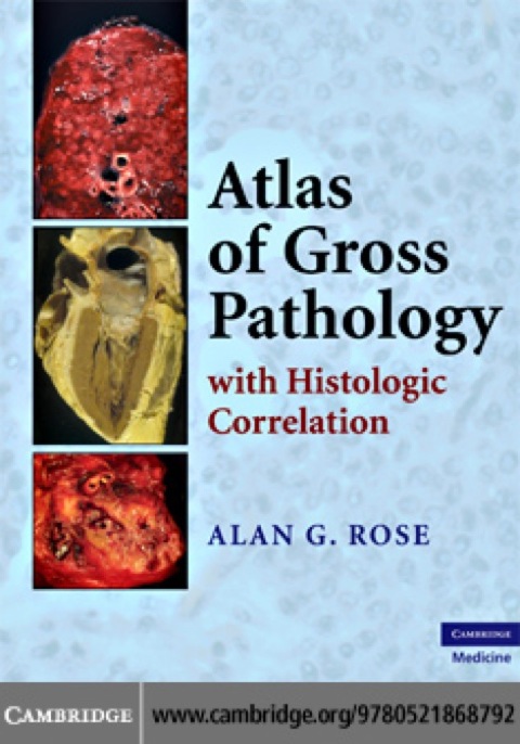 Cover image for book Atlas of Gross Pathology