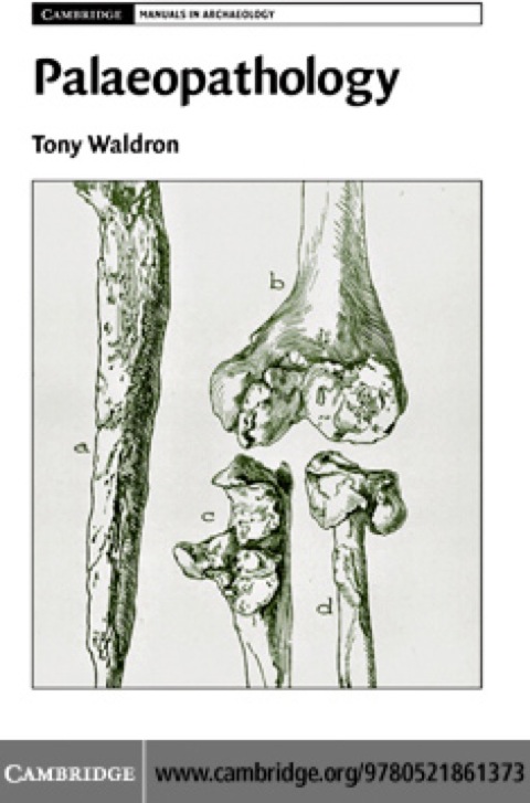 Cover image for book Palaeopathology