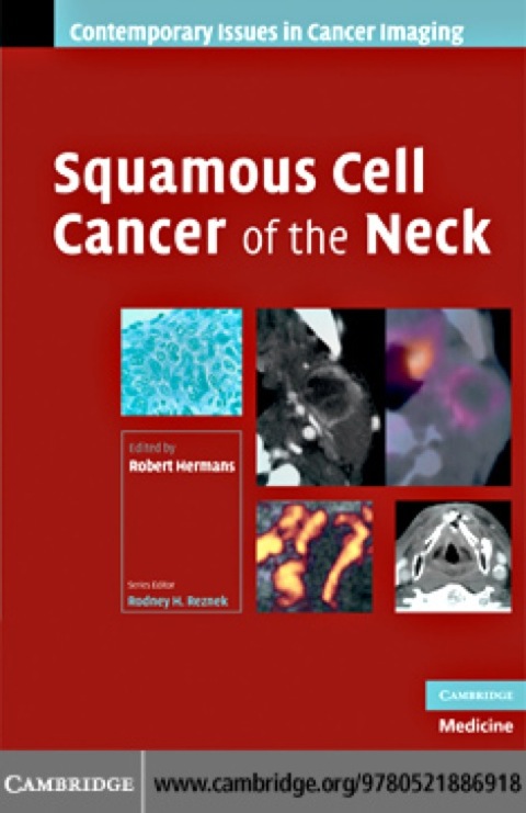 Cover image for book Squamous Cell Cancer of the Neck