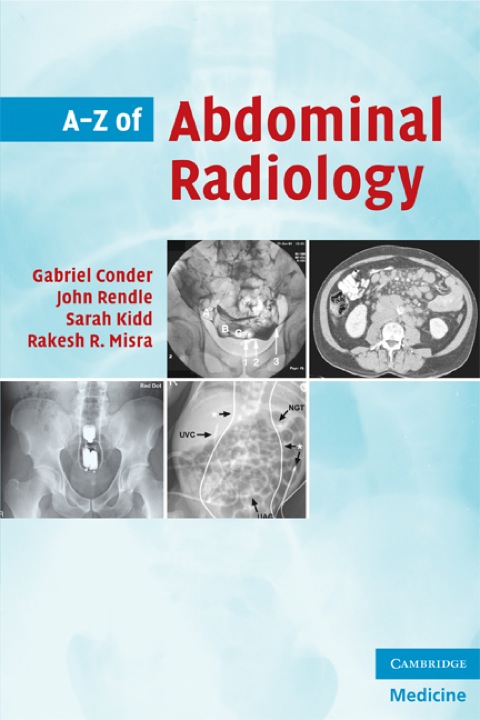 Cover image for book A-Z of Abdominal Radiology
