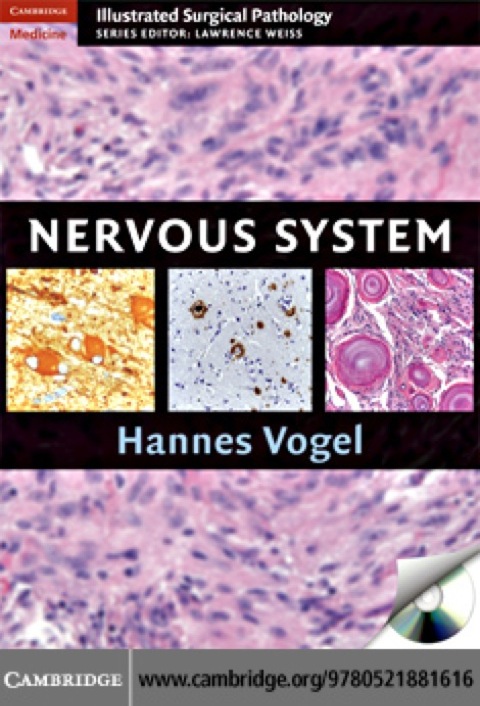 Cover image for book Nervous System