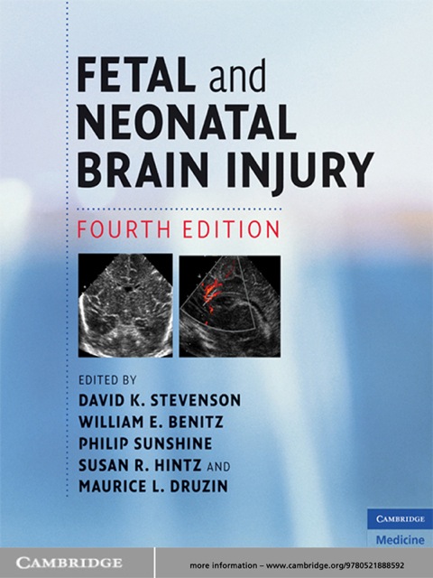 Cover image for book Fetal and Neonatal Brain Injury