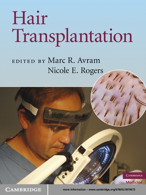 Cover image for book Hair Transplantation