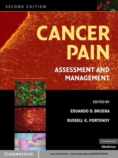 Cover image for book Cancer Pain