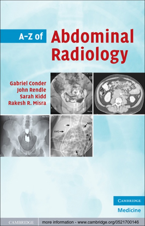 Cover image for book A-Z of Abdominal Radiology