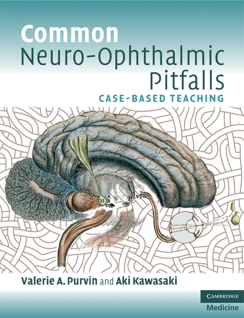 Cover image for book Common Neuro-Ophthalmic Pitfalls