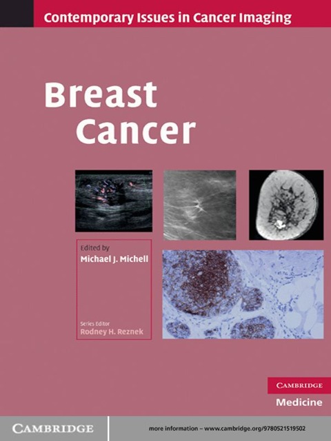 Cover image for book Breast Cancer