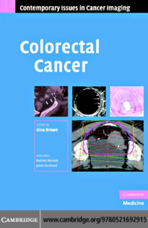 Cover image for book Colorectal Cancer