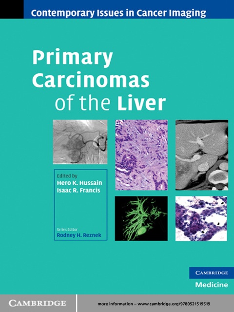Primary Carcinomas of the Liver 