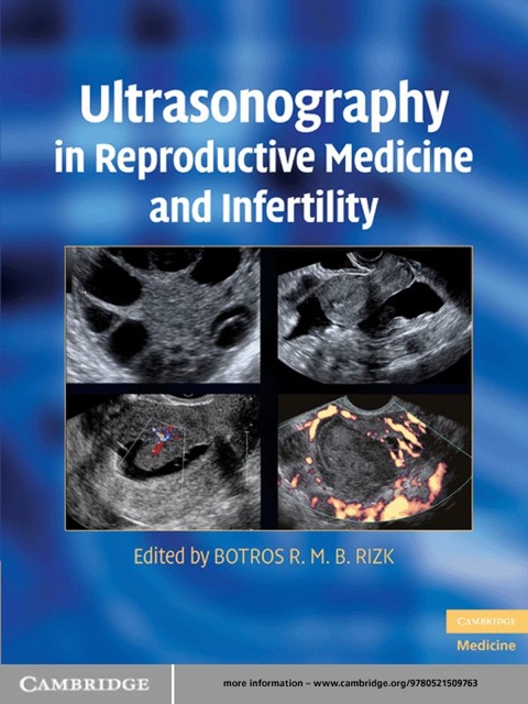 Cover image for book Ultrasonography in Reproductive Medicine and Infertility