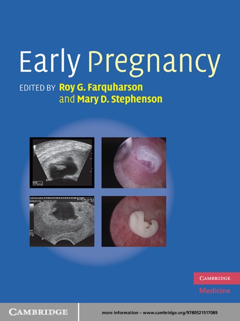Cover image for book Early Pregnancy